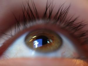 Supporting image for story: New research offers hope for diabetes patients with sight loss