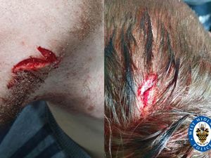 Supporting image for story: Appeal after man glassed and robbed in Birmingham