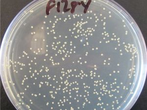 Supporting image for story: Scottish scientists to spend two years studying MRSA antibiotic resistance