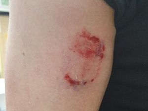 Supporting image for story: Woman jailed after police officer bitten in New Year's Day attack