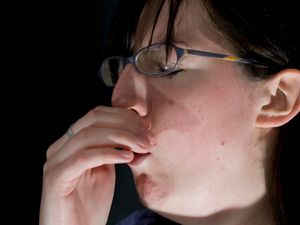 Supporting image for story: Scientists identify six different ‘types’ of Covid-19