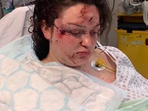 Supporting image for story: Pregnant woman loses baby after hit-and-run driver 'leaves her for dead'