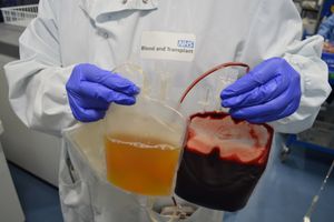 The first NHS patients now receiving medicine made from the blood plasma of Shropshire blood donors.