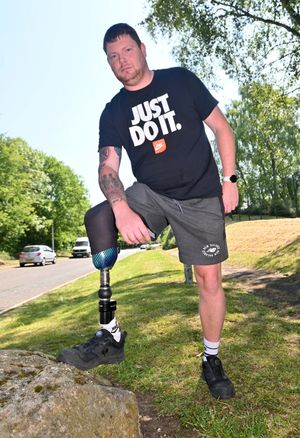 Shaun Rigby 37. A working man and lost his leg aged 2. He has been filmed playing cricket and has now lost his Motability car and PIP payments too.