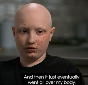 Yuvraj's appeal film has been broadcast on Channel 4 for Stand Up To Cancer