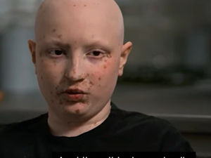 Supporting image for story: I questioned my family and said: ‘Is this going to make me die?’ Telford teen opens up about tough cancer treatment