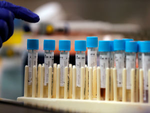 Supporting image for story: Coronavirus: 44 more deaths across region as UK death toll reaches 12,107