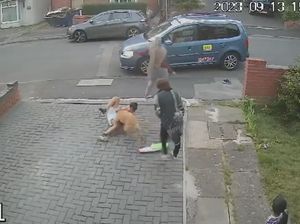 Supporting image for story: Boy, 10, needs stitches after being mauled by out-of-control dog outside his Walsall home