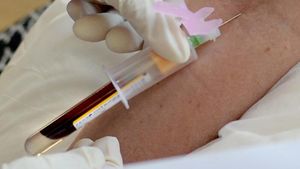 Supporting image for story