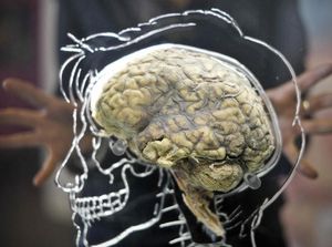 Supporting image for story