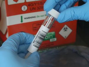 Supporting image for story: Covid-19 immunity could only last a few months – study