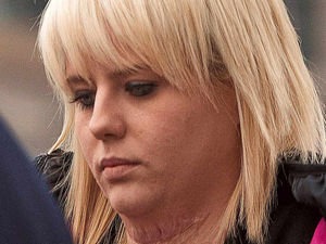 Supporting image for story: Sister: I was forced to lie about Sandwell doorstep acid attack