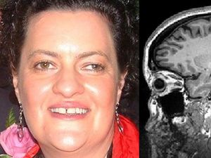 Supporting image for story: Blind woman can see objects – but only when they move – in extremely rare case