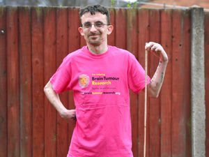 Supporting image for story: Rowley Regis man grows 18 inches following brain tumour surgery - this is why