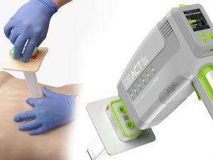 Supporting image for story: Student designs lifesaving device that rapidly stops blood loss from stab wounds