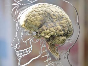Supporting image for story: Single brain scan could diagnose Alzheimer’s disease, study suggests