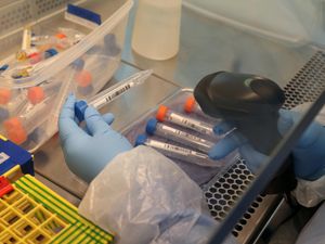 Supporting image for story: Volunteers urged to sign up for vital Covid studies as final-stage vaccine trials get under way