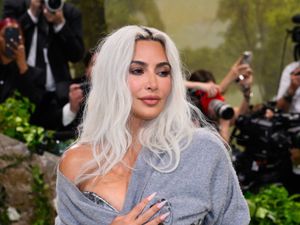 Supporting image for story: Kim Kardashian reveals one of her sons has the skin condition vitiligo