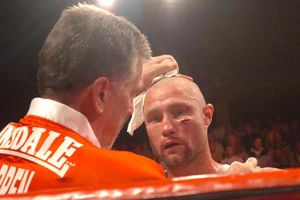 The cut that finished Darren McDermott's British title fight at the Civic in 2008.