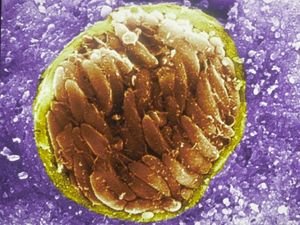 Supporting image for story: Brain parasite may be business tycoons’ secret weapon, study suggests