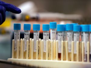 Supporting image for story: Testing confirms 21 coronavirus cases in outbreak at Shropshire caravan site