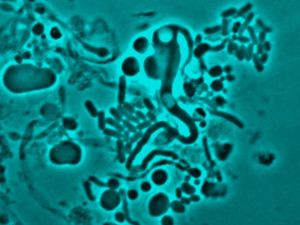 Supporting image for story: Full list of Greencore products recalled over E. coli fears