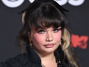 Supporting image for story: Singer Lola Young says she is ‘doing OK’ after collapsing on stage