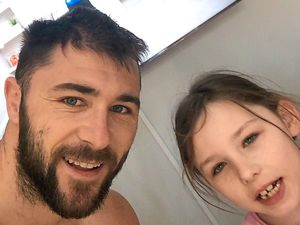 Supporting image for story: West Brom striker Charlie Austin on the mend
