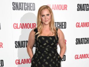 Supporting image for story: Amy Schumer says her 2026 is about ‘self care and love’