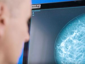 Breast cancer screening