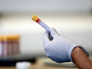 Supporting image for story: Early detection cancer tests ‘could be part of NHS screening within a decade’