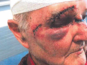 Supporting image for story: 70-year-old farmer badly beaten after disturbing intruder