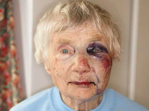 Supporting image for story: Family of widow, 88, attacked in her home are happy justice has been done