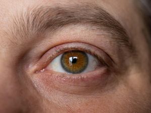 Supporting image for story: Researchers pinpoint LSD dose that could keep anxiety at bay for weeks