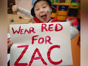 Supporting image for story: We turned red for Zac too - here's why