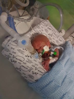 Haris Mockbill when he was born 