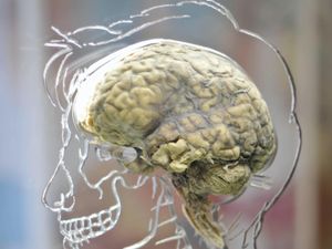 Supporting image for story: ‘Reversed brain’ linked to lower social and communication abilities – study