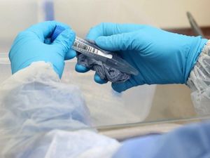 Supporting image for story: 'There is a very real risk of a second peak': Doctor warns against easing coronavirus lockdown