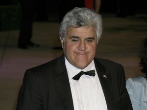 Supporting image for story: Jay Leno recalls how his ‘face caught on fire’ during recent car garage accident