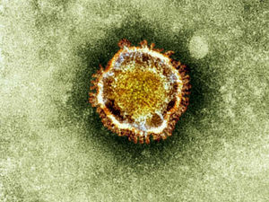 Supporting image for story: Shropshire Star comment: Coronavirus has changed our perspective