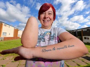 Supporting image for story: Scooter rideout to help get Telford mum Sam a bionic hand