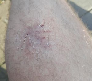 Christopher Geisler said his leg was bitten by a dog belonging to one of the travellers