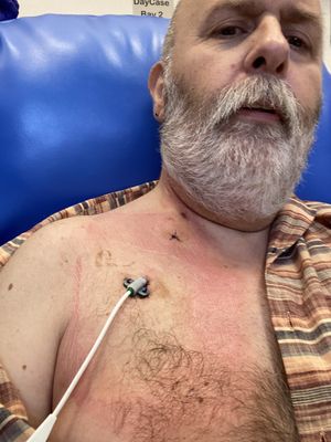 Brendan during treatment