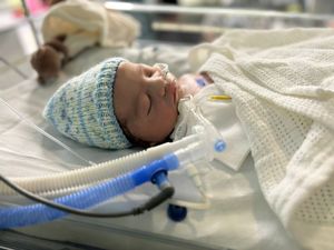Baby Rudi in Paediatric Intensive Care at Birmingham Children's Hospital