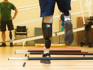 Supporting image for story: New software could reduce NHS waiting lists for prosthetic legs, study finds