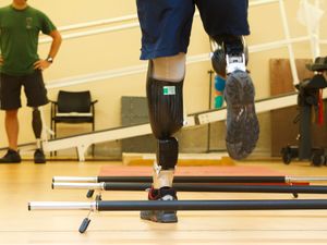 Supporting image for story: New software could reduce NHS waiting lists for prosthetic legs, study finds