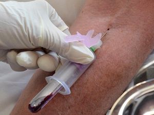 Supporting image for story: Blood test ‘can detect more than than 50 types of cancer’