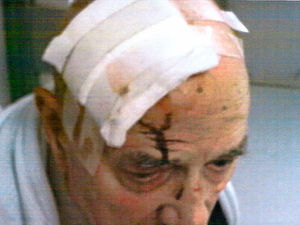 Supporting image for story: Thugs break 84-year-old man's hip in Bilston car-jacking