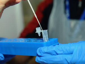 Supporting image for story: Pandemic is not over warns health boss