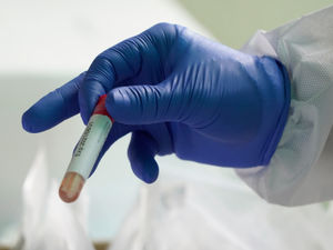 Supporting image for story: Another Covid death confirmed in county